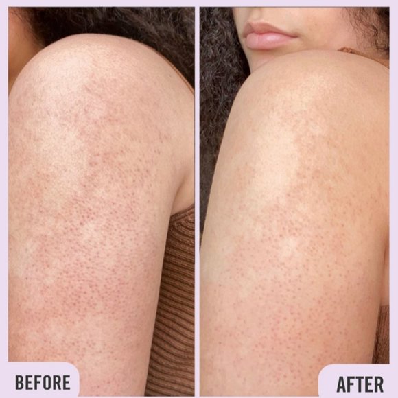 F.A.B. KP BUMP ERASER BODY SCRUB 10% AHA $35 - Picture 5 of 9